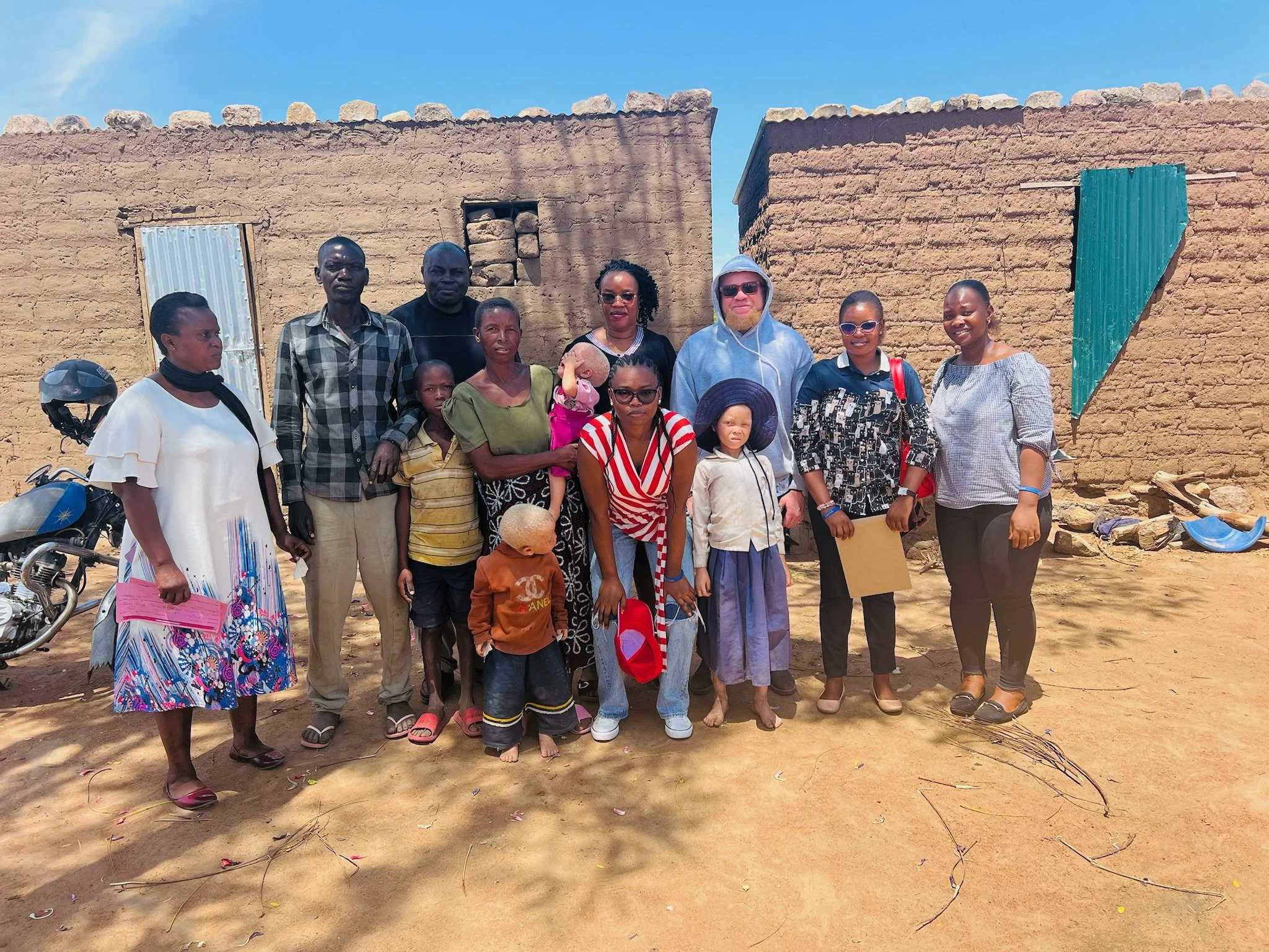 Aisha’s Story: Hope for Children with Albinism in Tanzania