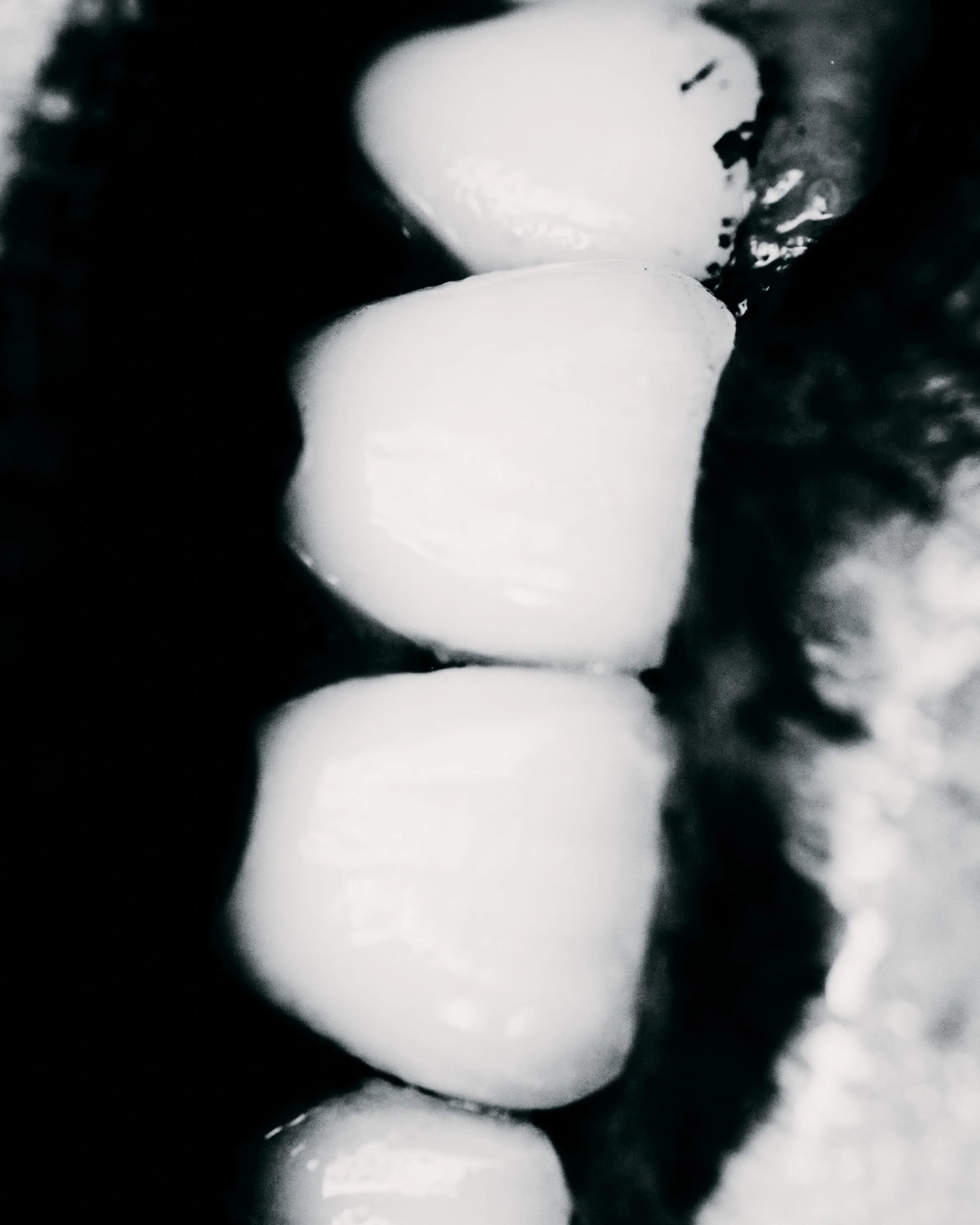 TEETH 23.jpg