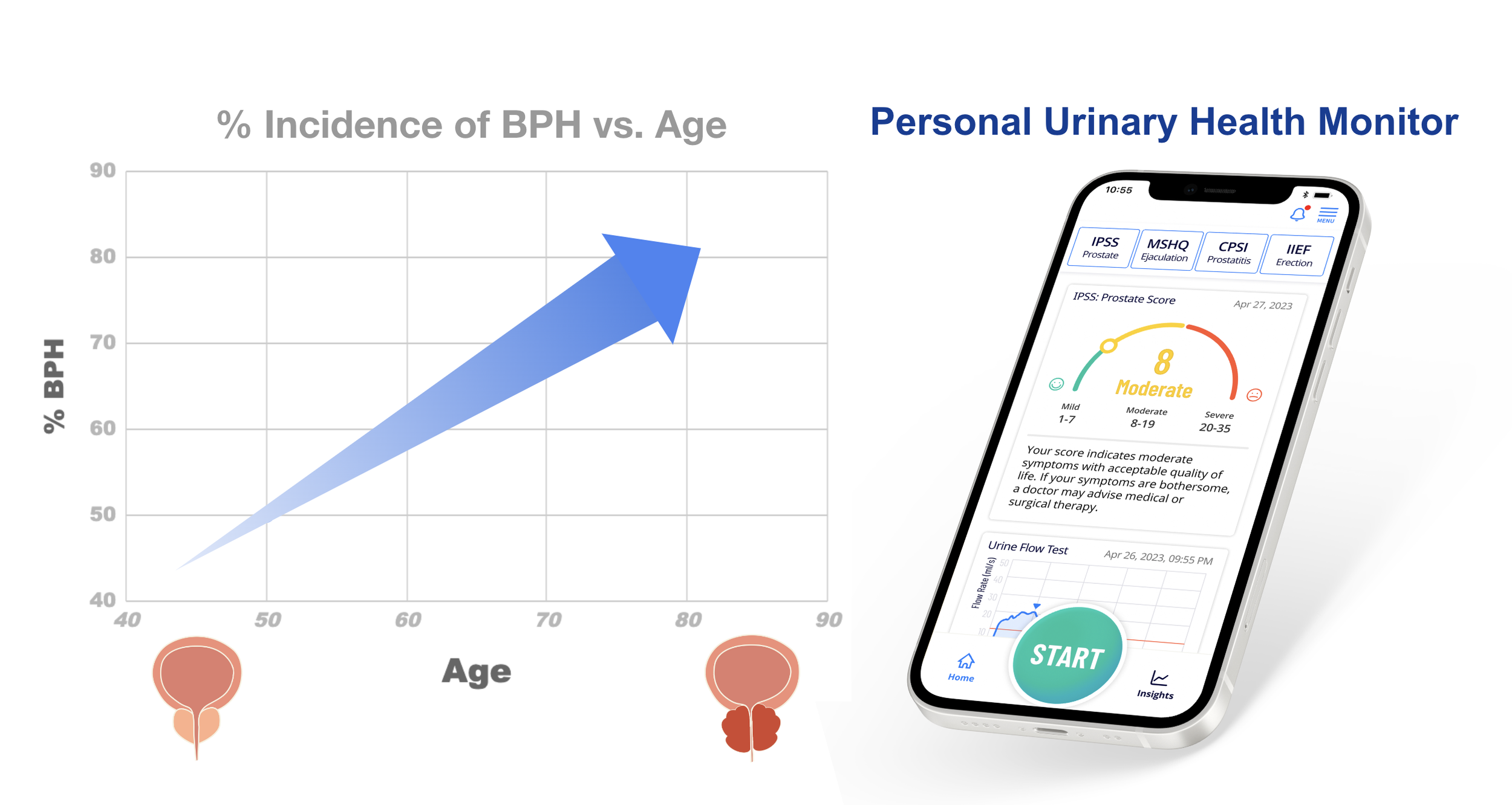 Incidence of BPH increases over age — proudP Personal Prostate Health