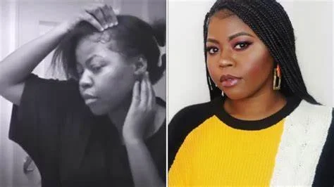 HOW TO COMPLETELY STOP THE ITCH IN WIGS