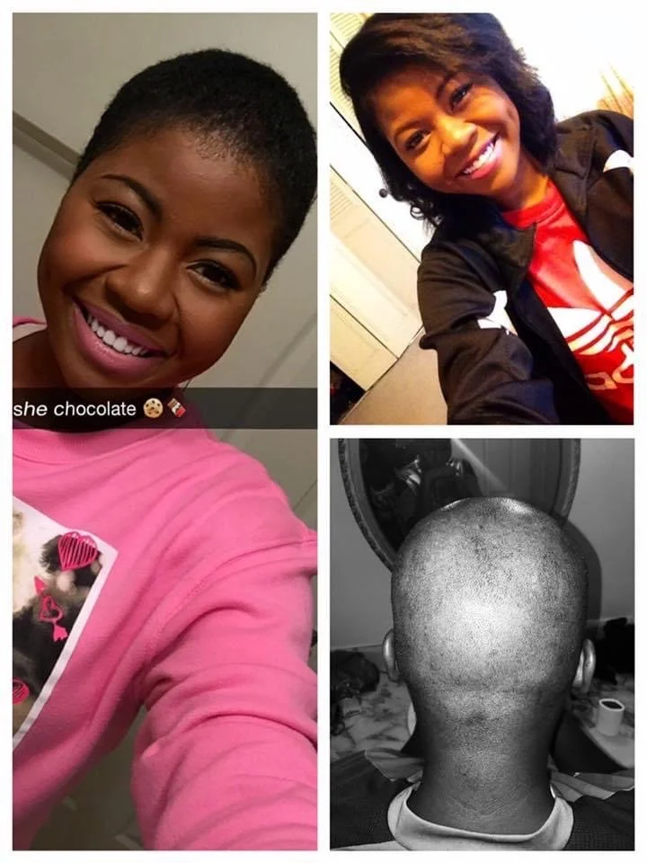 Homemade Egg Hair Mask Recipes For All Hair Types