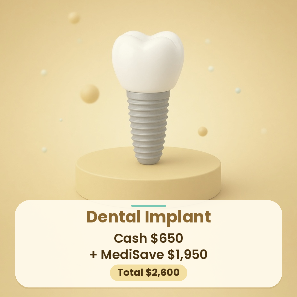Dental implant price at Smileplus Dental: cash $650 plus MediSave $1,950, total $2,600