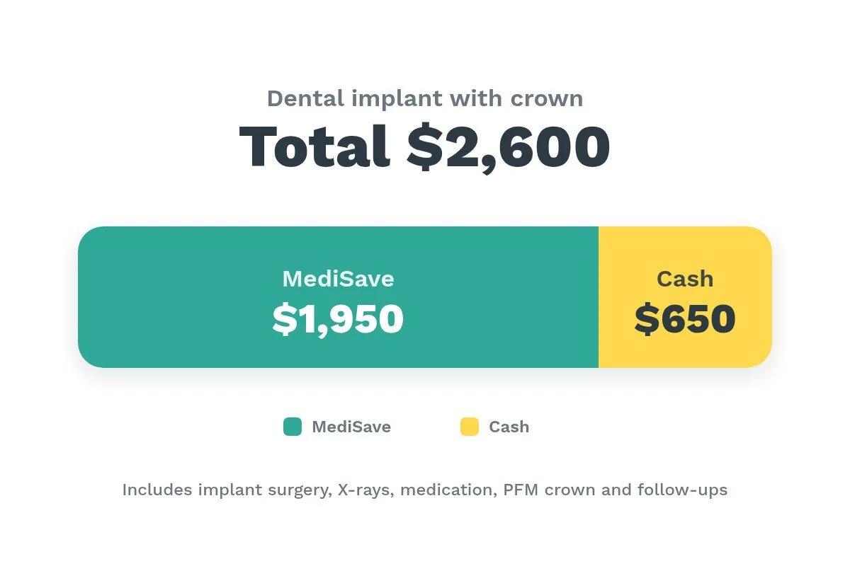 Infographic showing the $2,600 total implant cost split into $1,950 claimable from MediSave and $650 paid in cash