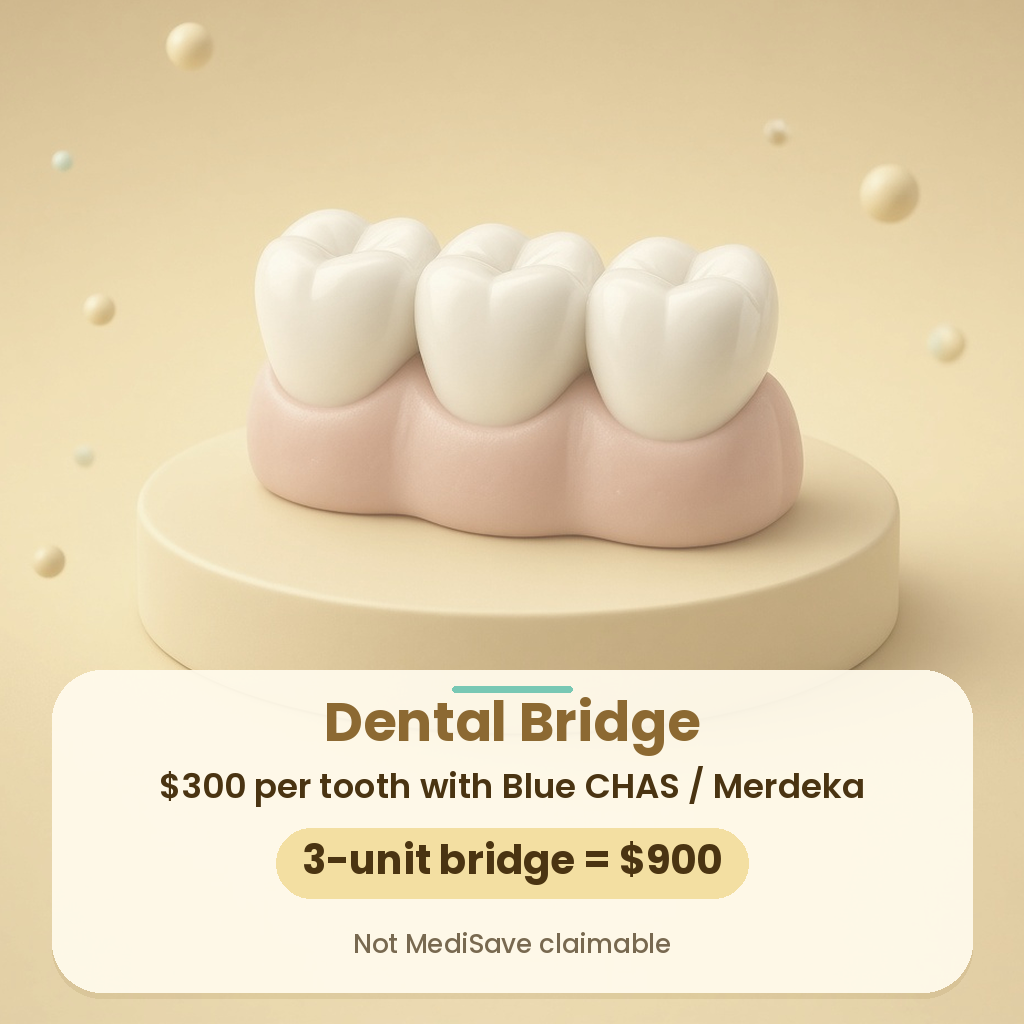 Dental bridge price at Smileplus Dental: $300 per tooth with Blue CHAS or Merdeka, 3-unit bridge $900, not MediSave claimable