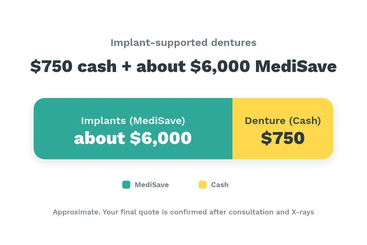 Bar graphic showing implant-supported dentures cost $750 cash for the denture plus about $6,000 from MediSave for the implants
