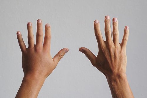 The Vancouver Hand Clinic