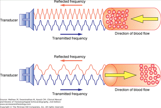 echocardiogram doppler ultrasound diagram