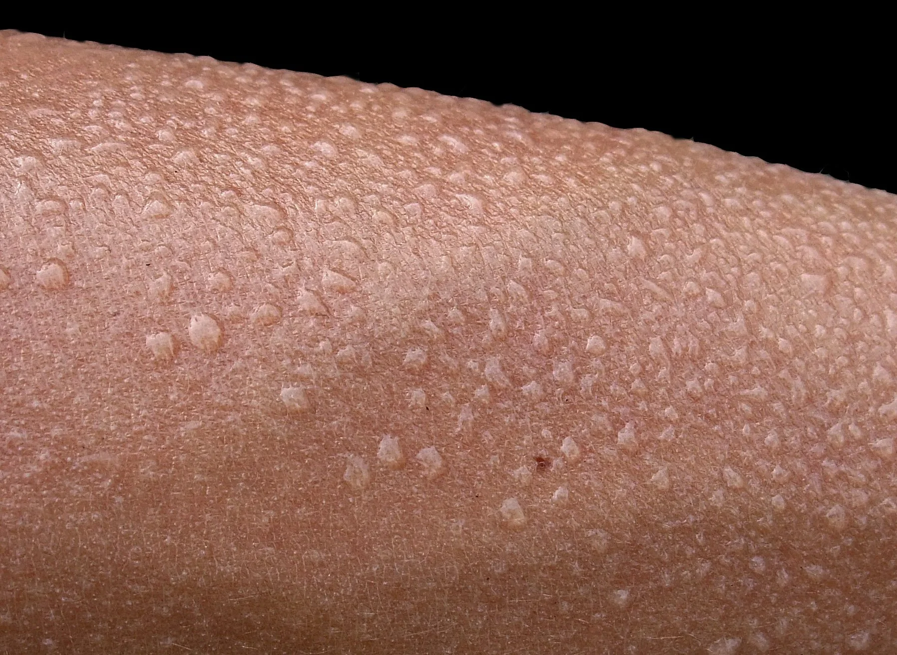 Close up of someone's skin with beads of sweat