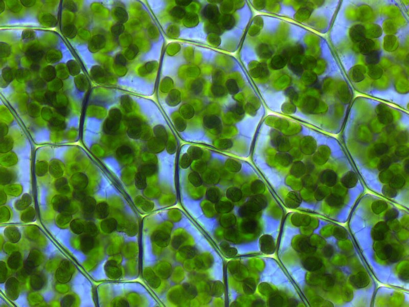 This is a close-up image of plant cells with visible chloroplasts, found in a type of moss.