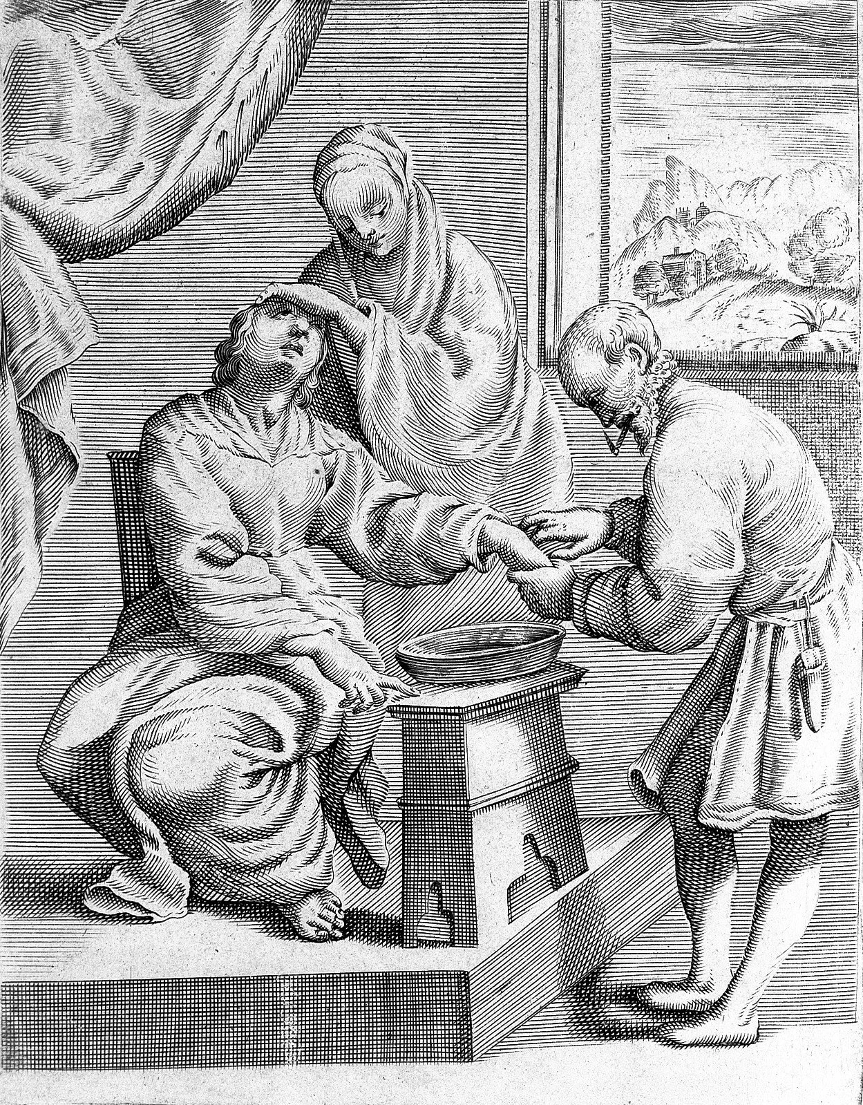 Image from a 17th-century medieval book showcasing bloodletting of the hand.