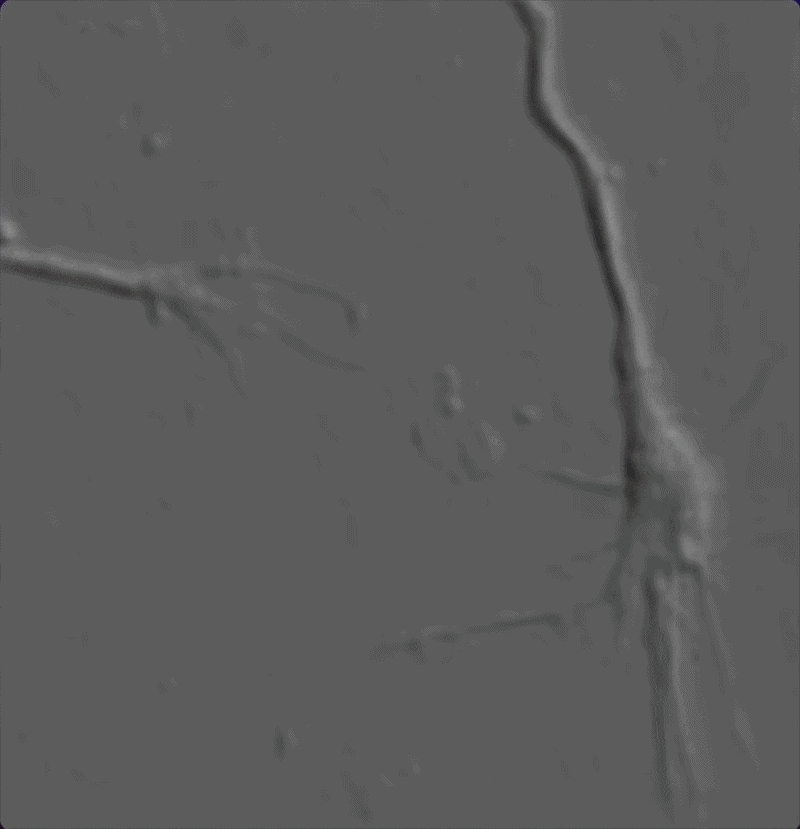 GIF showing axonal sprouting