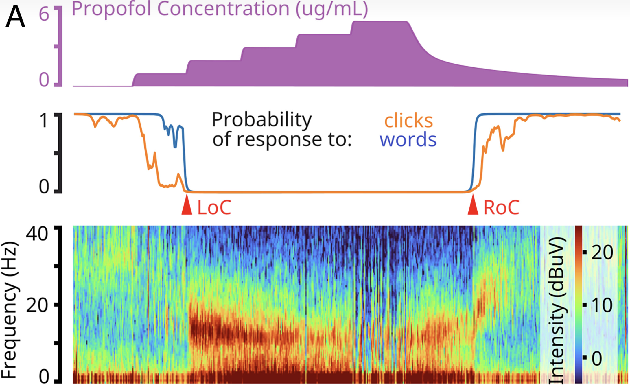 From top to bottom: These diagrams show how, as the patient receives more anesthesia (propofol) and they lose consciousness (LoC = loss of consciousness), their higher frequency brain waves (40Hz) become quieter.
