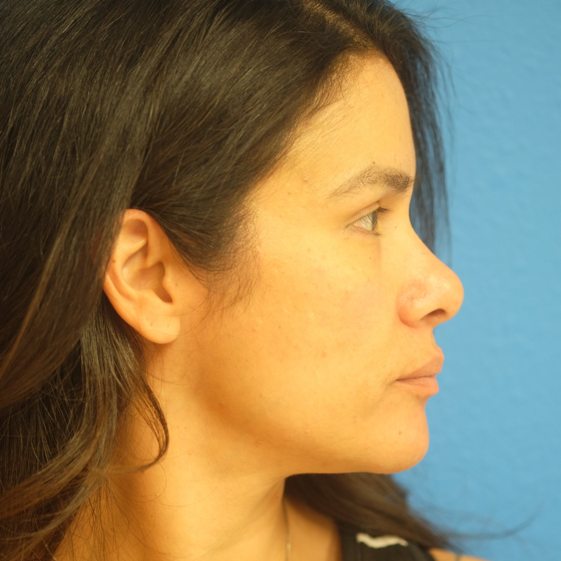 DSCF9441.jpg