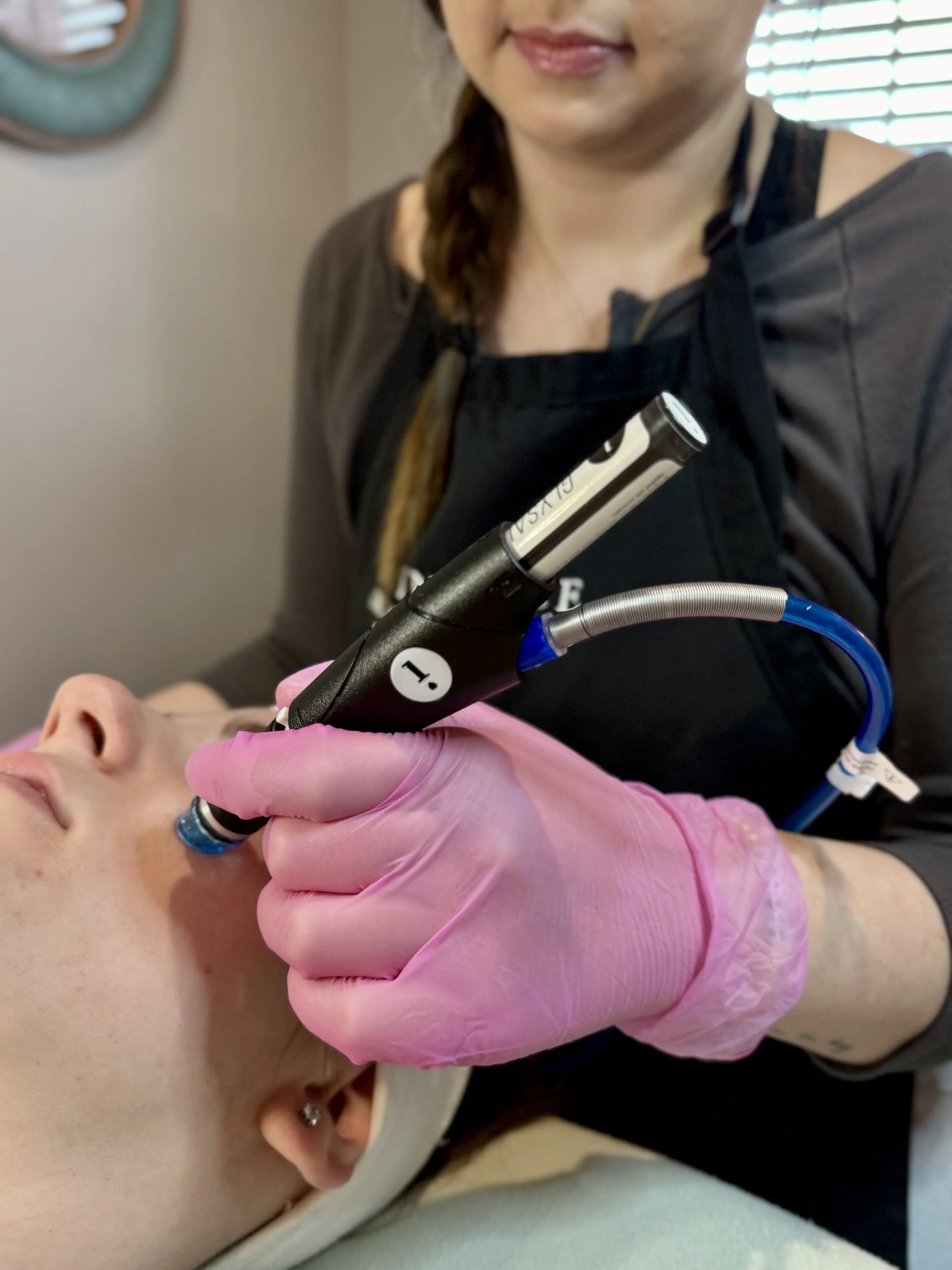 Why the Deluxe Hydrafacial Is Worth the Upgrade