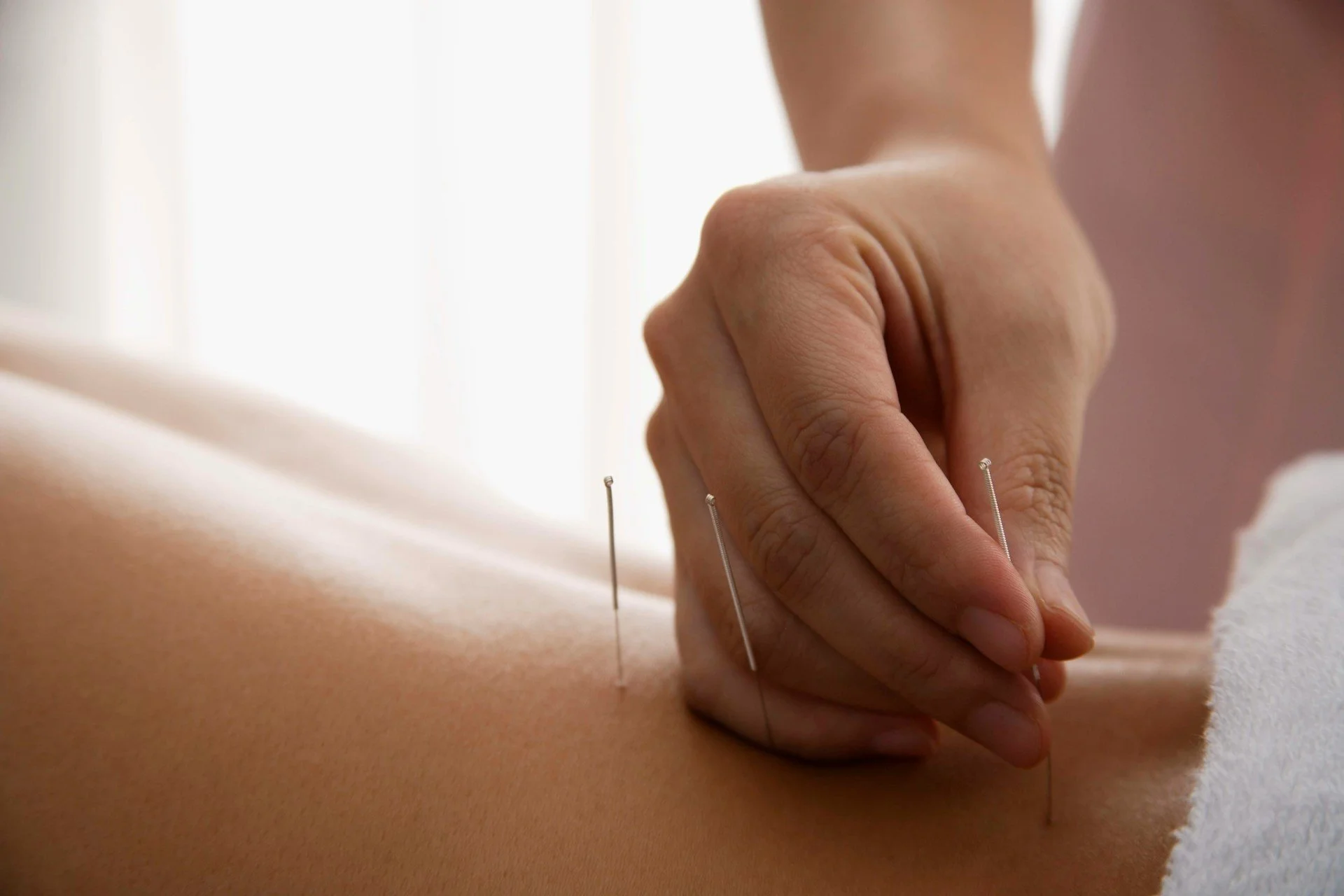 How a Westport Acupuncturist Helps Reset After Holiday Stress
