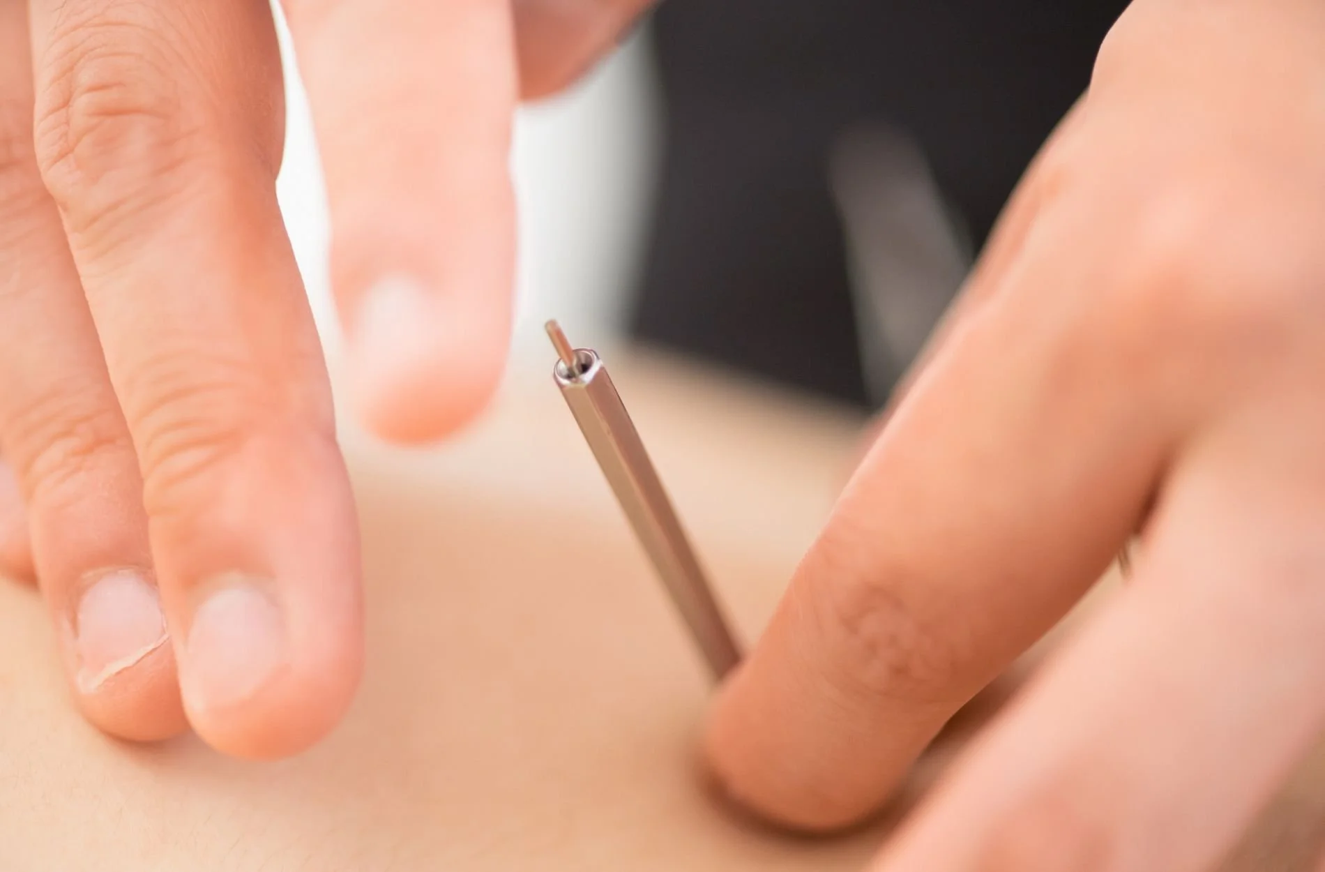 What Prenatal Acupuncture Can Offer in Early Spring