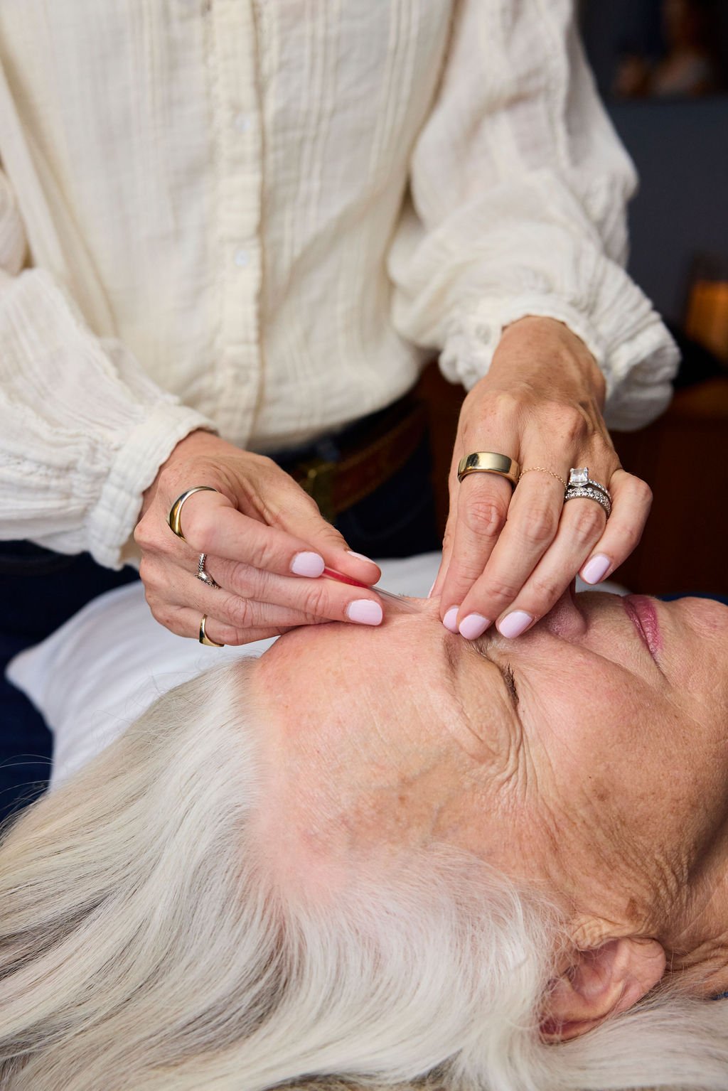 Does Acupuncture Actually Work? Yes! Here's What It Helps With Most