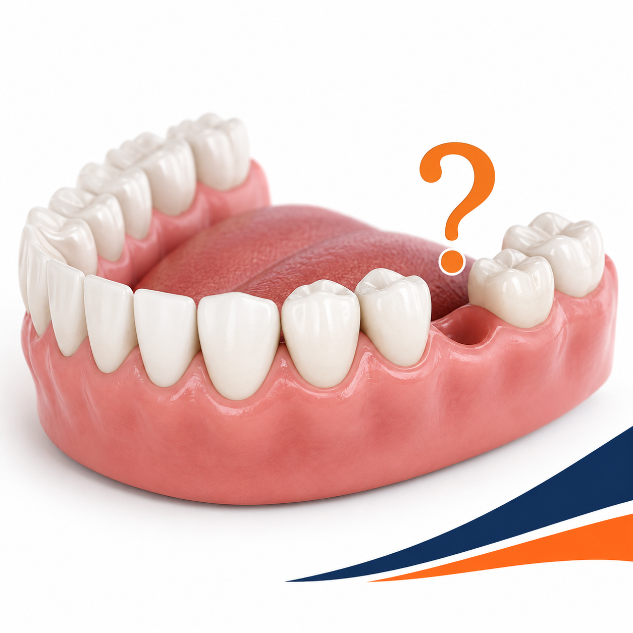 Do You Really Need to Replace a Missing Tooth? What Happens If You Don’t
