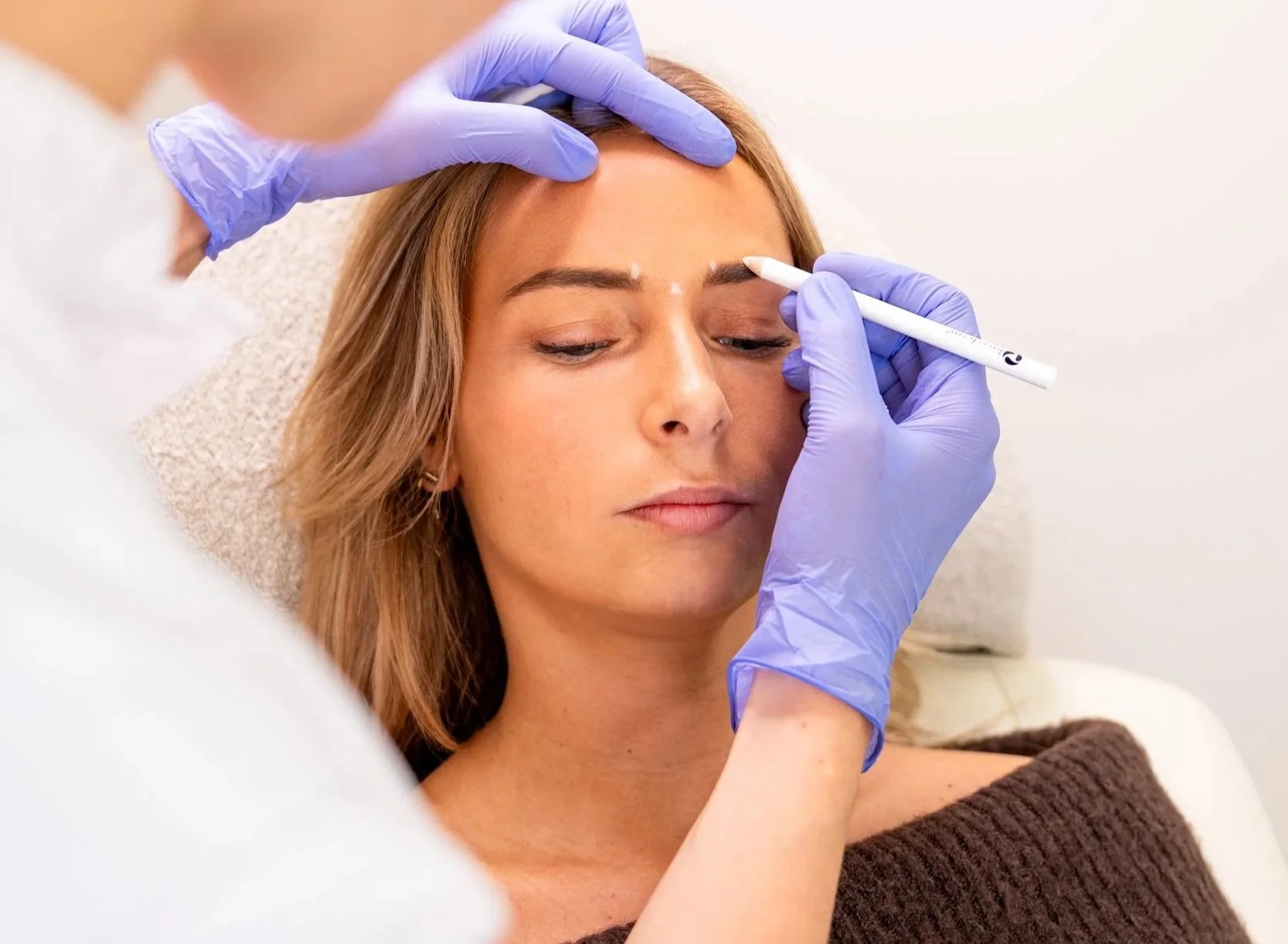 Vrouw met migraine ligt in behandelstoel en arts zet stipjes waar hij gaat prikken tegen migraine