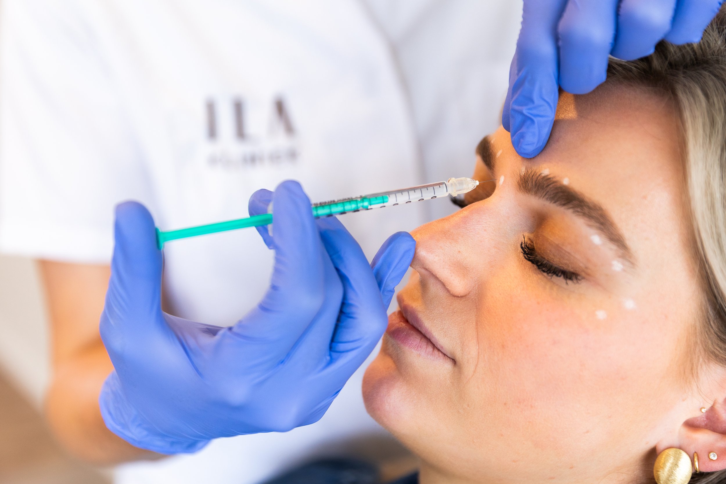 Cosmetisch arts spuit met handschoenen aan en een injectienaald botuline toxine tussen de wenkbrauwen van haar klant.