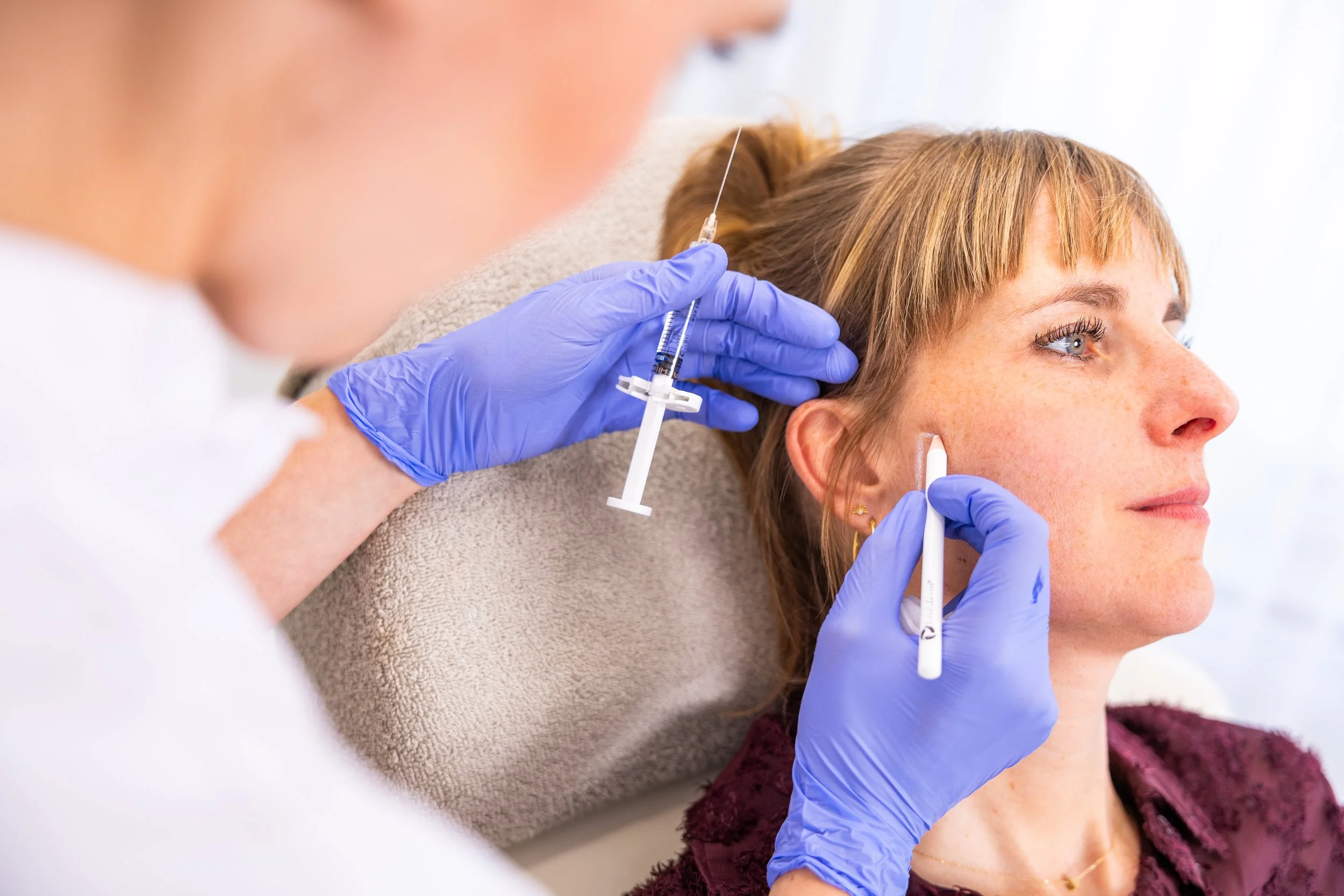 Close up van klant ligt in stoel en arts heeft lijnen profhilo structura afgetekend en wil starten met behandeling