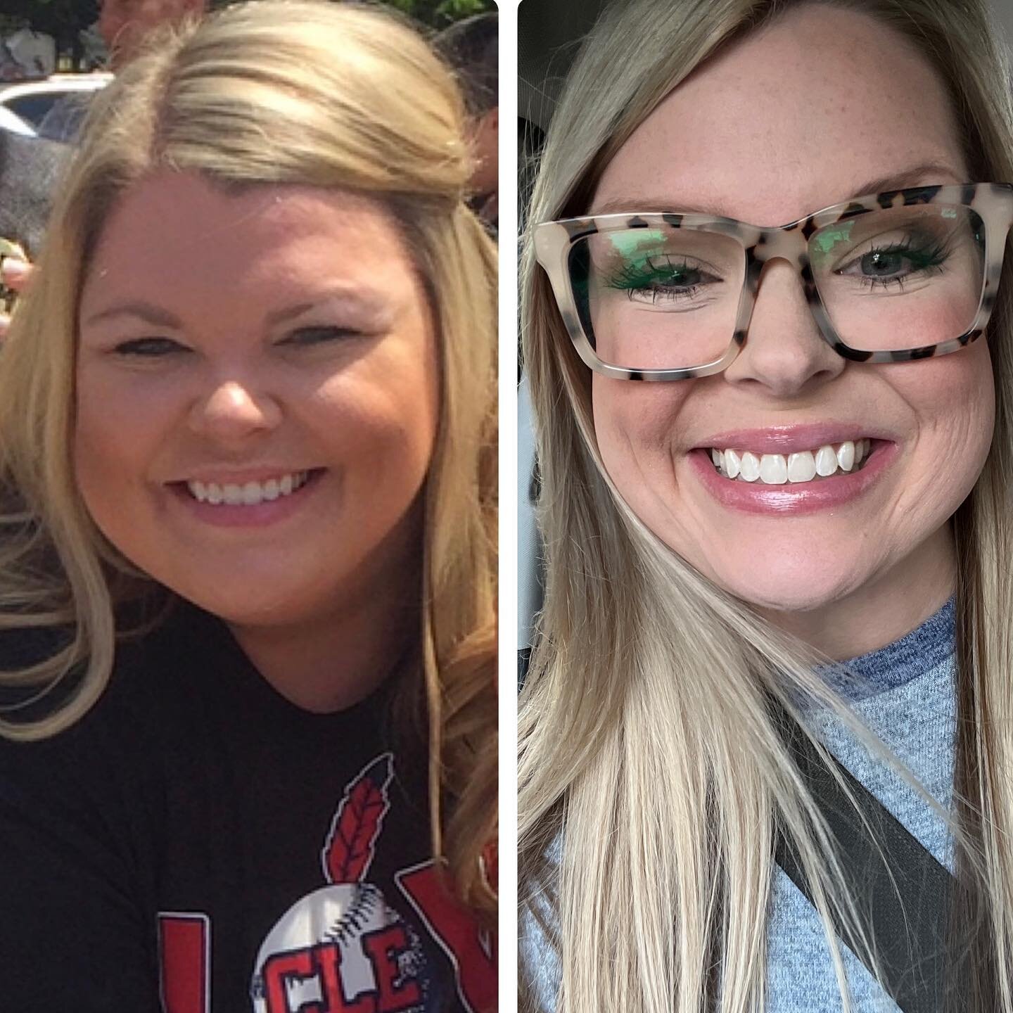 I love how hard I am smiling in both photos. Genuinely happy in both photos and really in both bodies.

I wasn&rsquo;t unhappy in a 338 pound body. But it was hard to live in it. 

Daily tasks were difficult. It was hard to put my socks and shoes on.