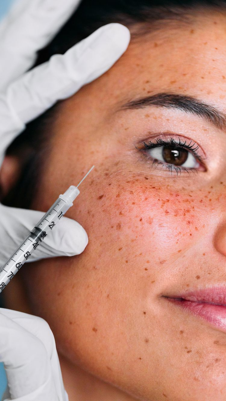      

 
    Prevention vs. Correction: When to Consider Anti-Wrinkle Treatments   One of the most common questions we hear at  Dr Tranter Aesthetics  is:  “When should I start anti-wrinkle treatments?”  The answer isn’t one-size-fits-all. It depends