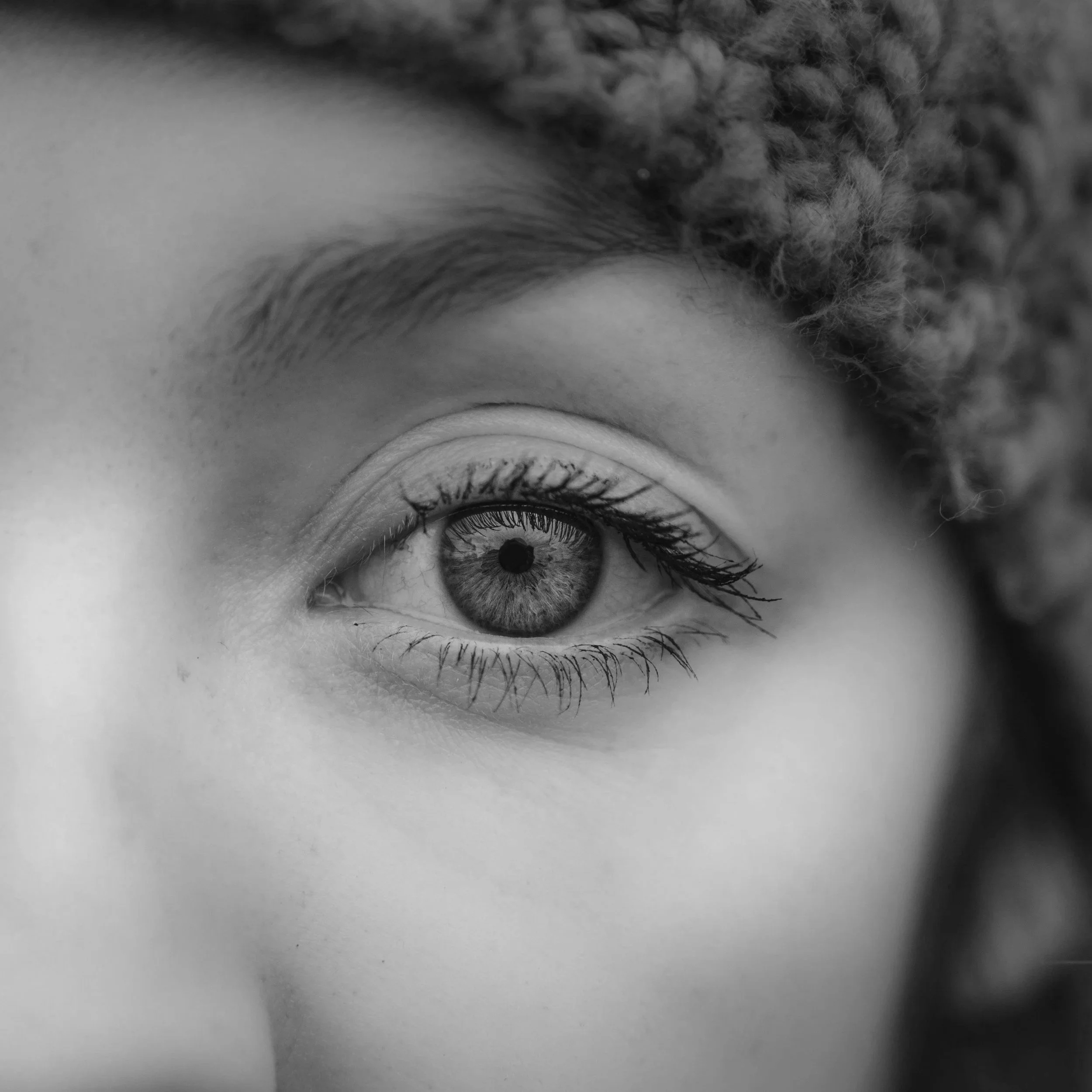 Why You May Need a Brow Lift Instead of an Upper Blepharoplasty