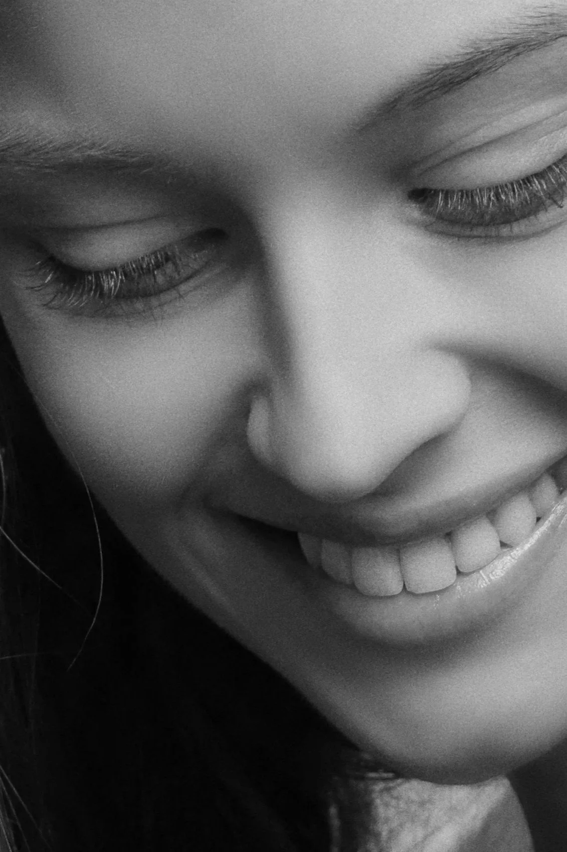 Why Doesn't My Nose Look Straight After Rhinoplasty?