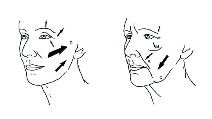 Why I use the Deep Plane Facelift