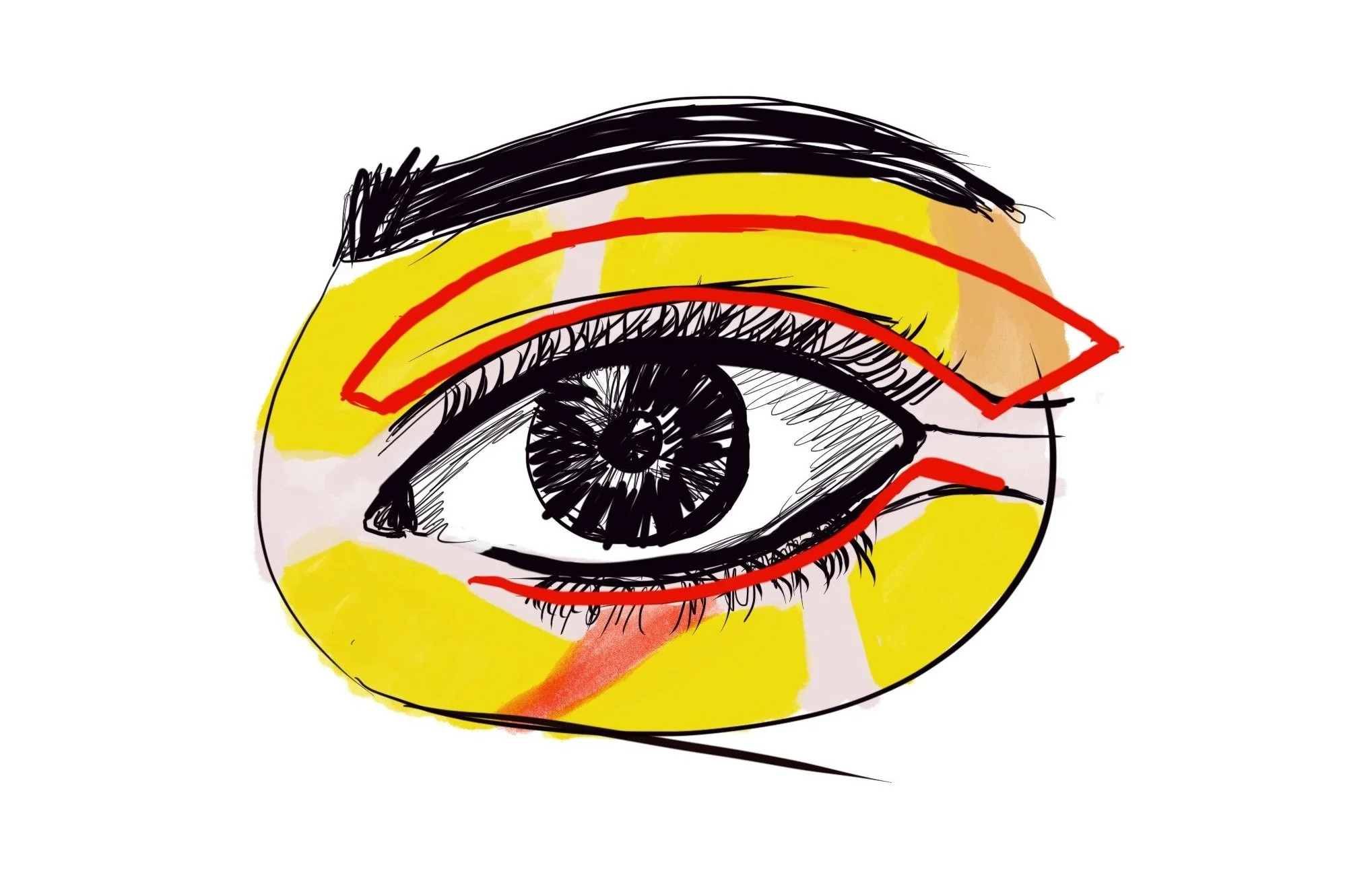 Blepharoplasty markings