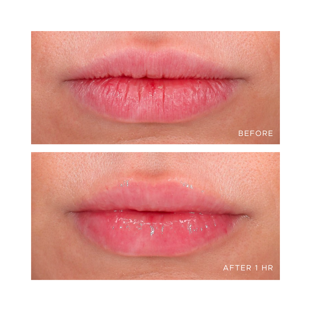 ANFISASkin_Gloss_B+A.png