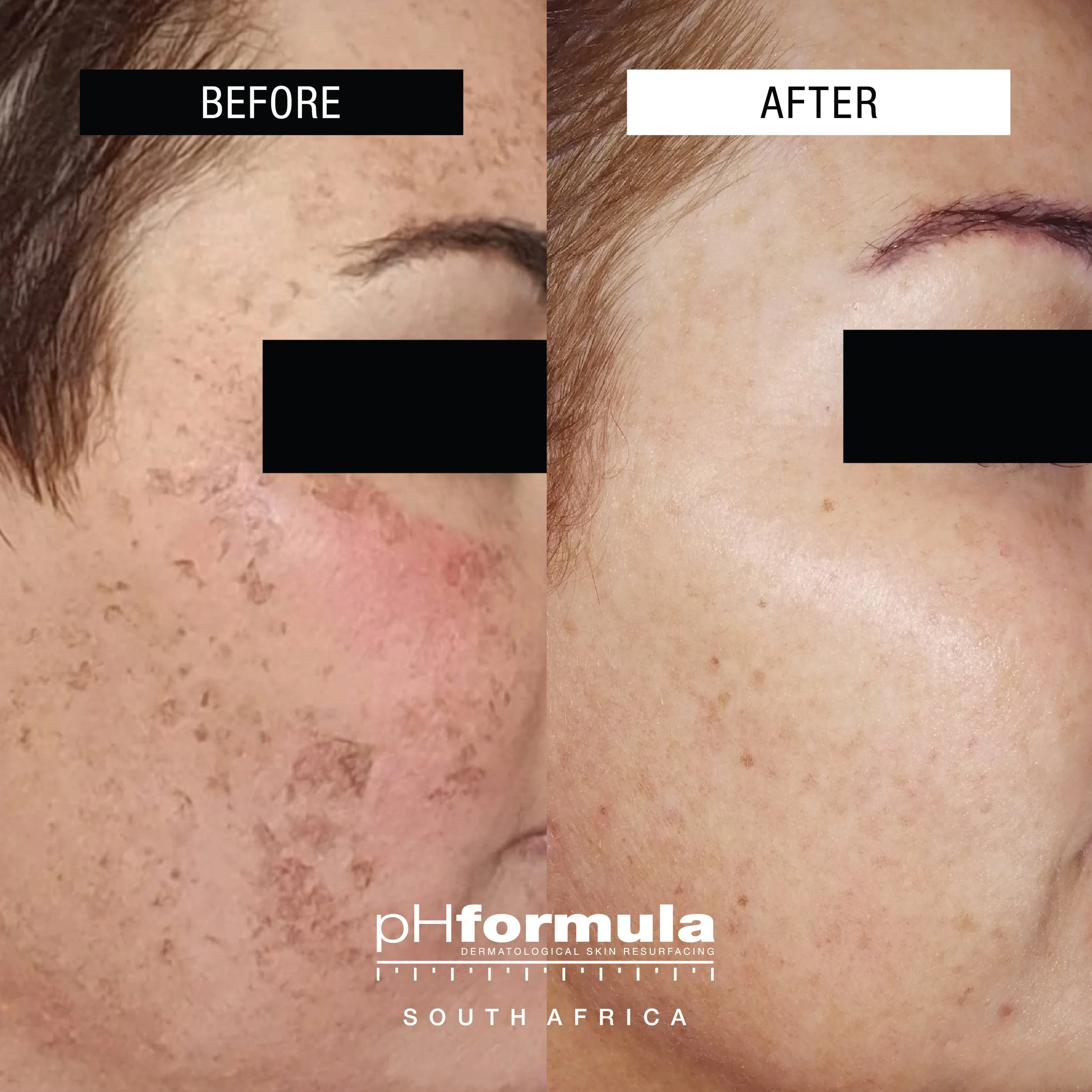 pigment bij V-Cosmetics