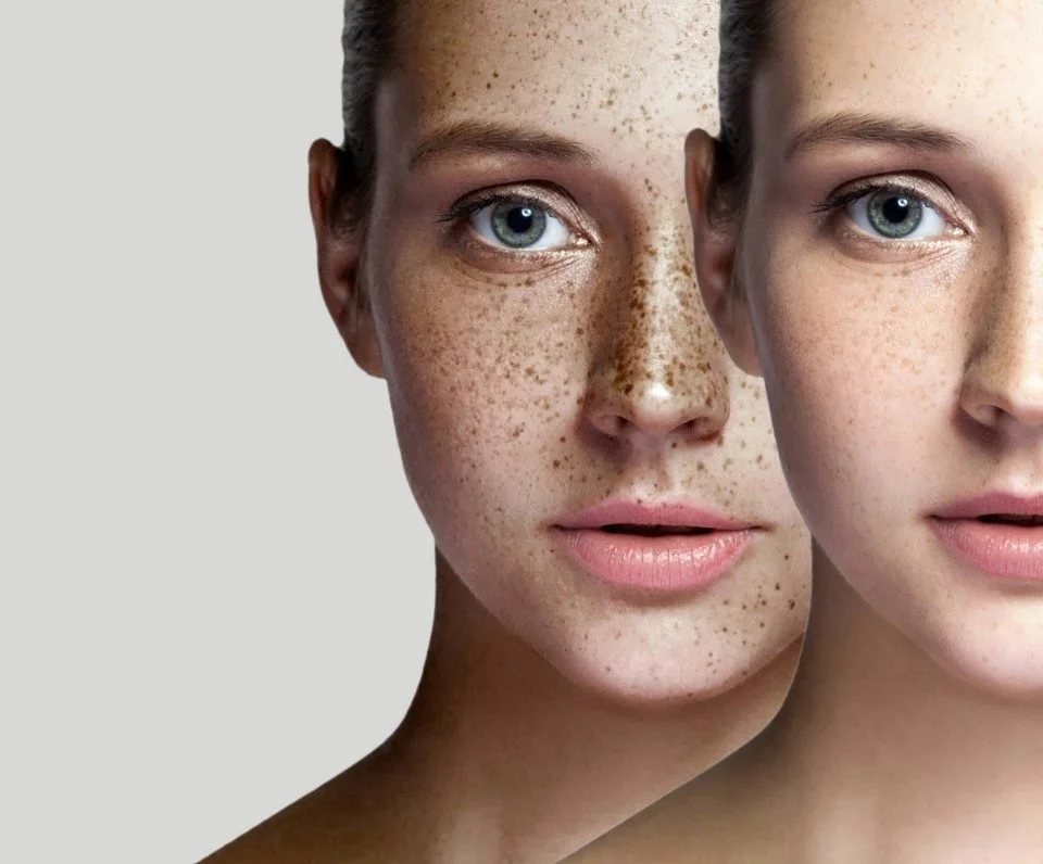 Me Line bij V-cosmetics