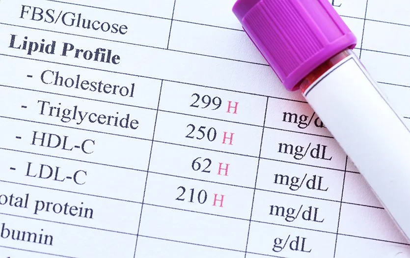 Medical lab report showing lipid profile results, including cholesterol, triglycerides, HDL-C, LDL-C, and total protein, with a pink-capped blood sample tube resting on top.