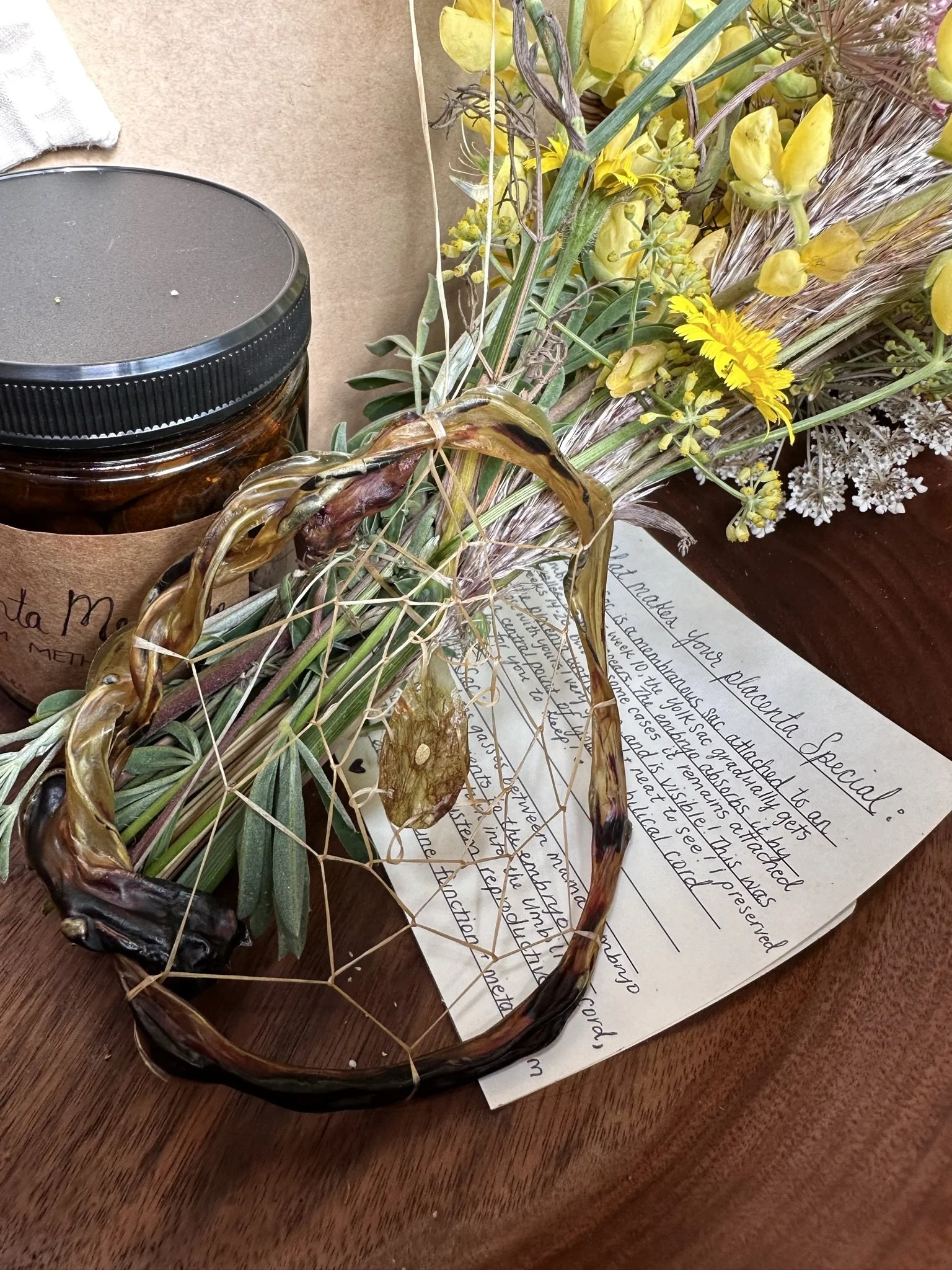 Umbilical Cord Keepsake