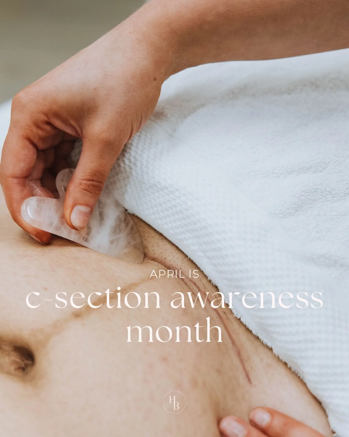 April is C-Section Awareness Month ⚡️

This month is incredibly special to me, not just professionally, but personally through every woman I&rsquo;ve had the privilege of supporting.

As a scar release specialist, I see firsthand that a c-section bir