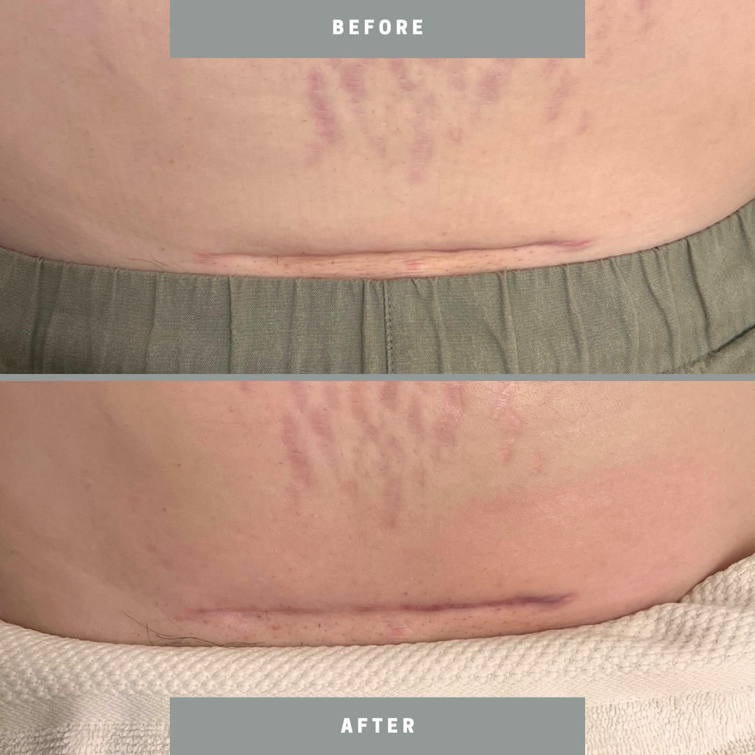 Untitled design.zip - 6.PNG