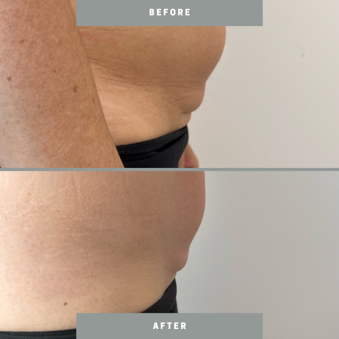 Untitled design.zip - 3.PNG