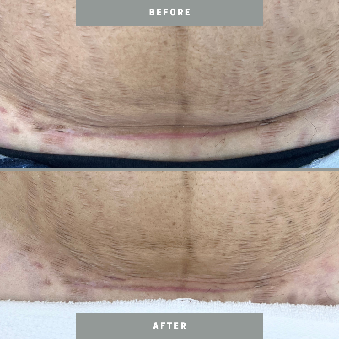 Untitled design.zip - 1.PNG