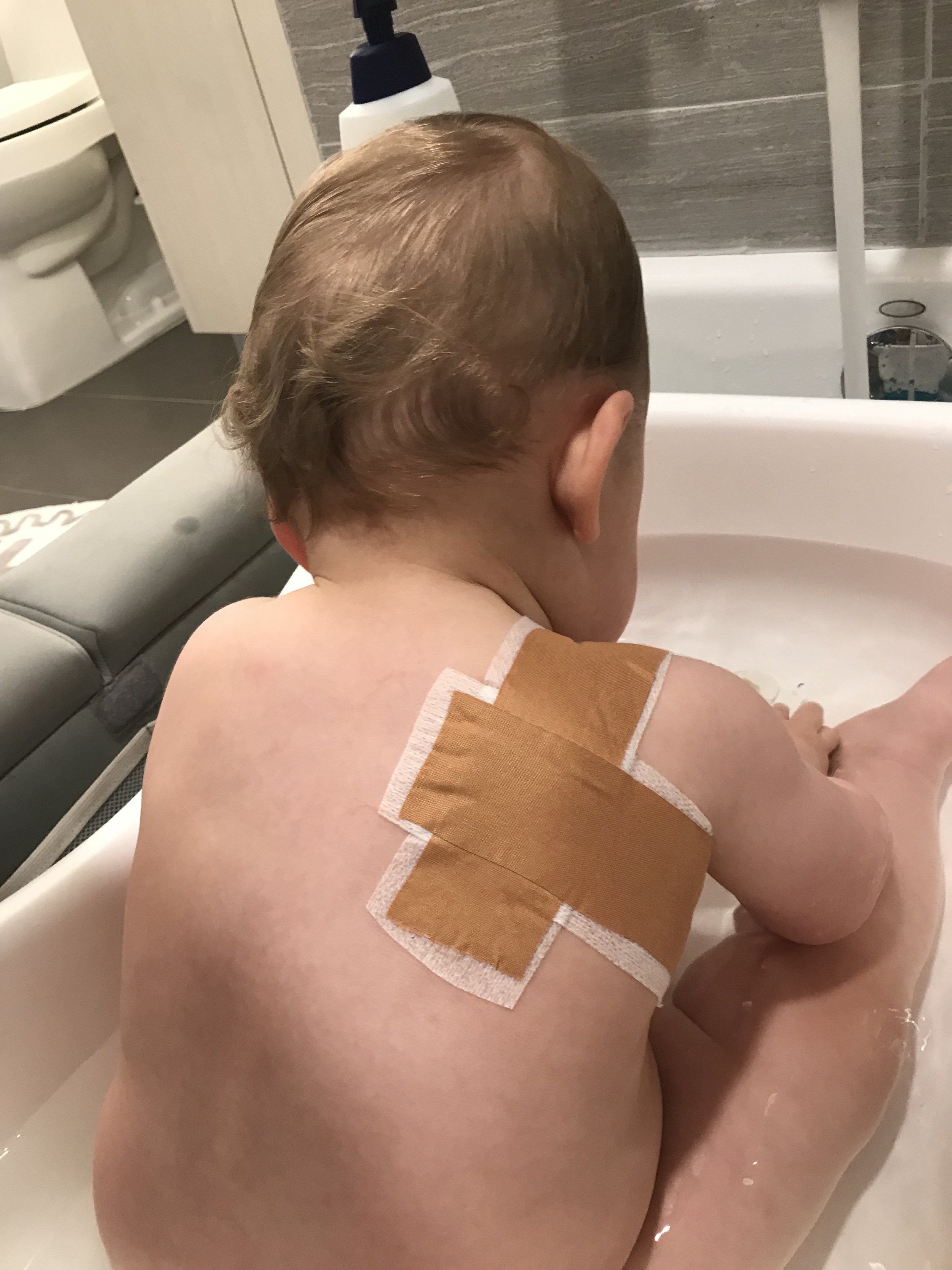 leukotape shoulder.JPG