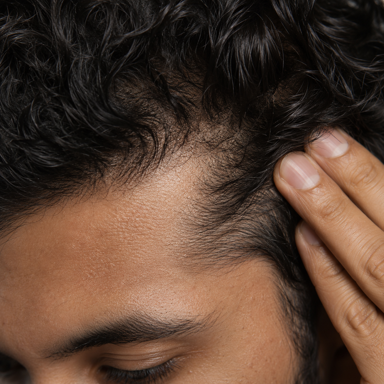 Temple and Hairline Texture Close-Up.png