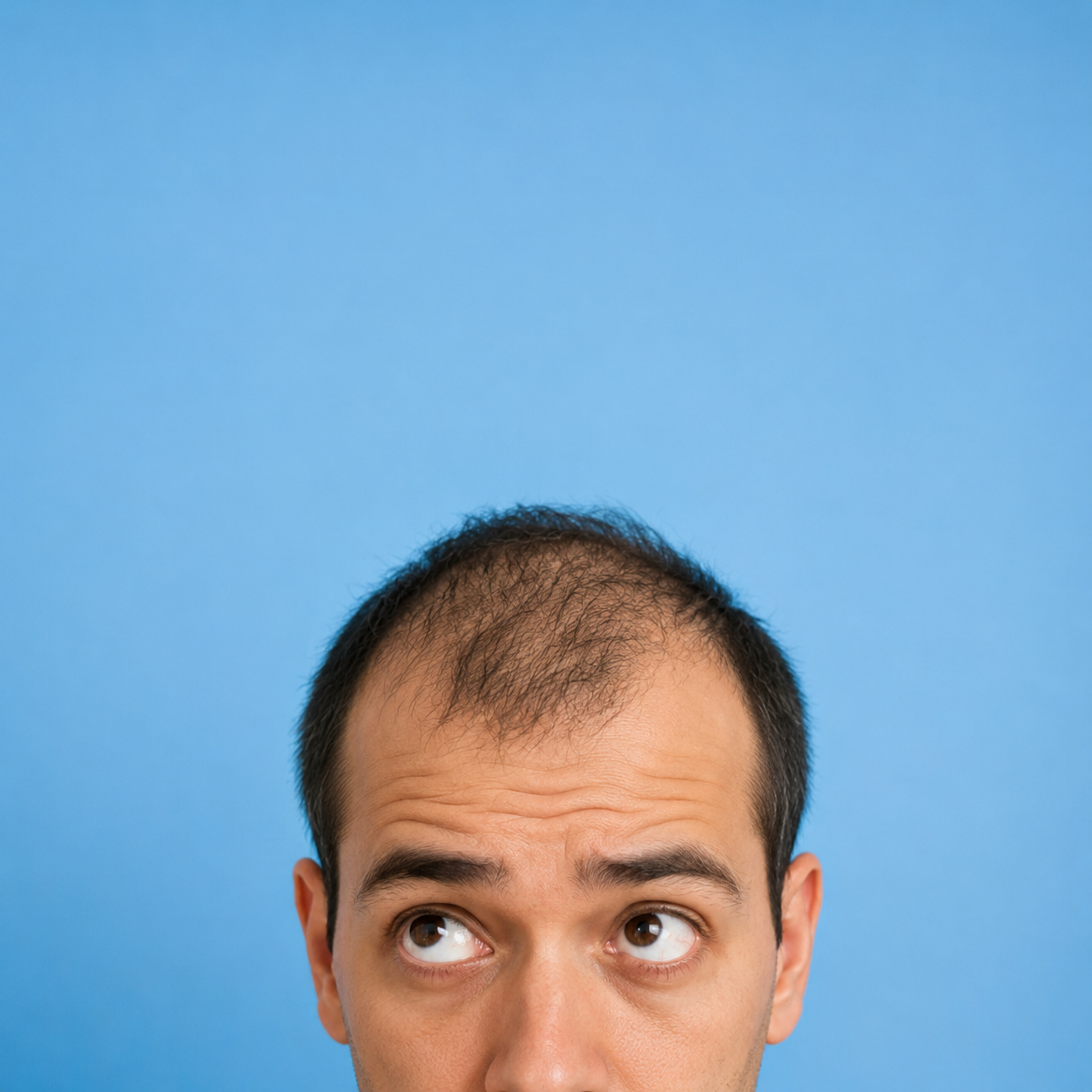 Upward Gaze, Thinning Hair.png