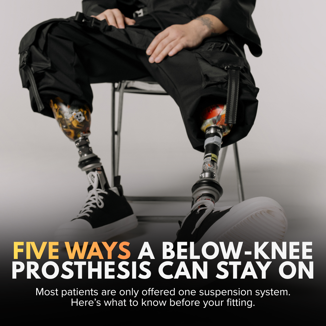 Below-Knee Prosthetic Types: Suspension Systems, Components, and How to Know Which Is Right for You