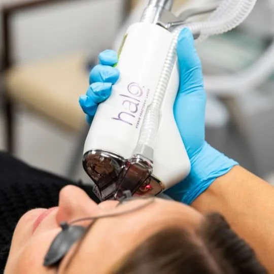 Aesthetic Laser Treatments for Beautiful Skin Sciton Lasers BBL, MOXI, HALO IPL and