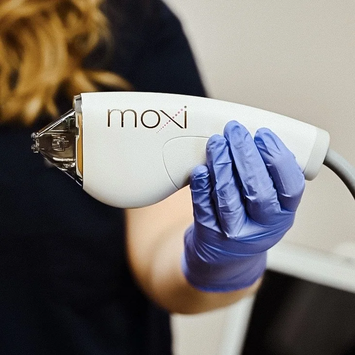 Aesthetic Laser Treatments for Beautiful Skin Sciton Lasers BBL, MOXI, HALO IPL and
