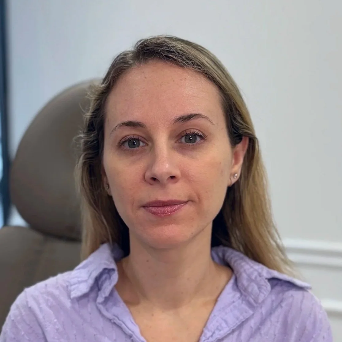 Female client after Neurotoxin treatment at Morph Med Spa in Ridgefield, CT – smoother forehead, brow, and eye-area appearance