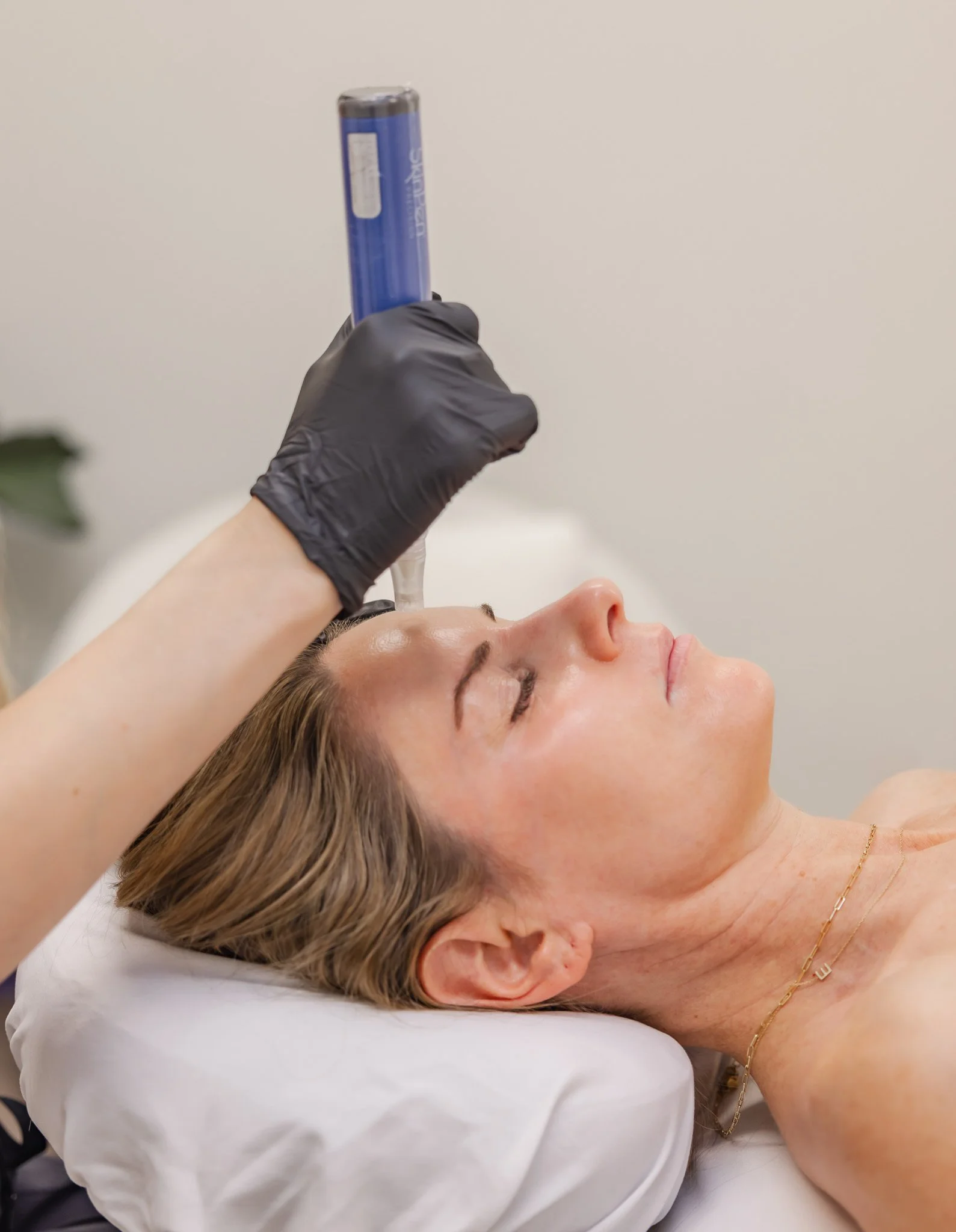Client receiving microneedling collagen stimulation treatment at Morph Med Spa in Ridgefield, CT
