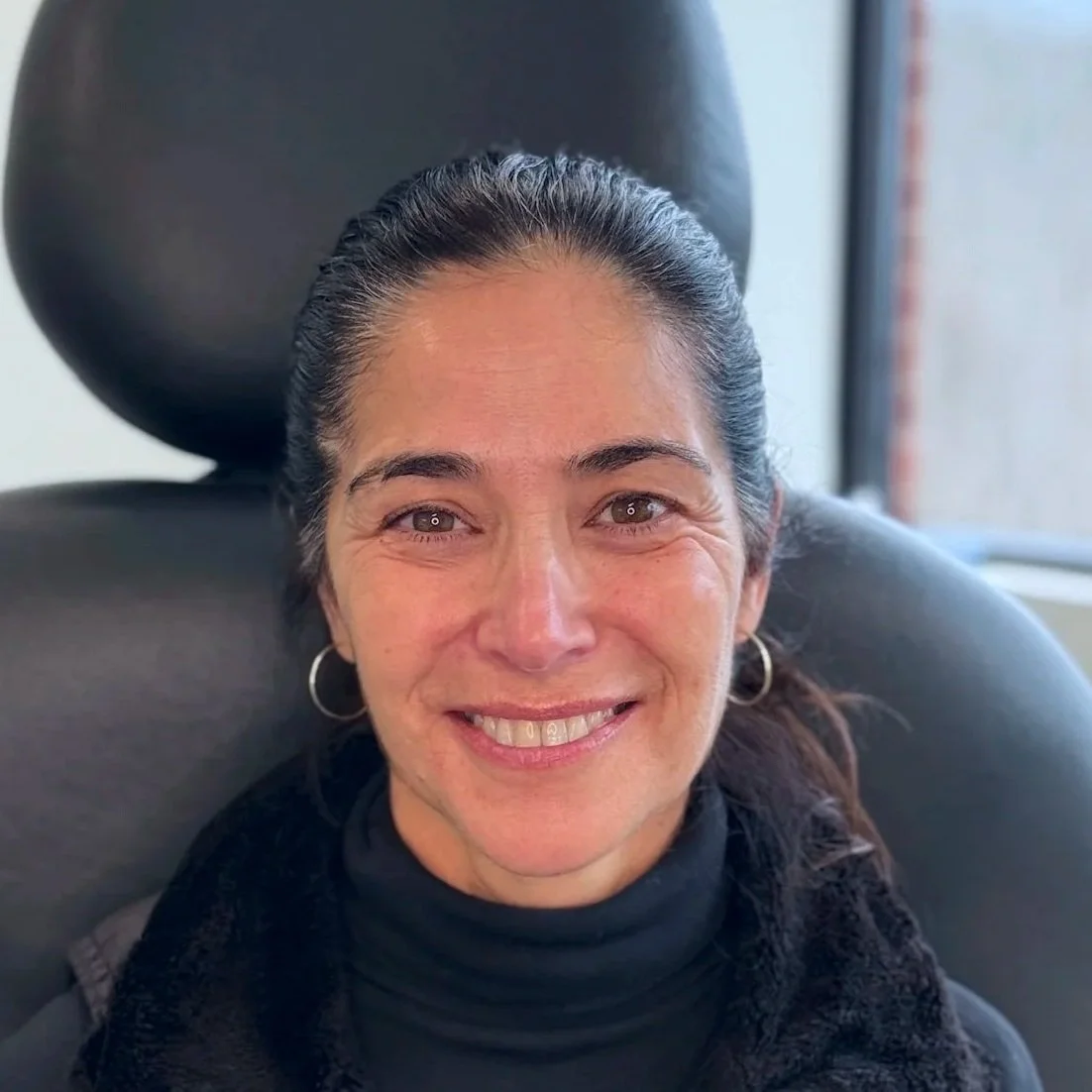 Female client before Neurotoxin treatment at Morph Med Spa in Ridgefield, CT – visible forehead, brow, and eye-area expression lines