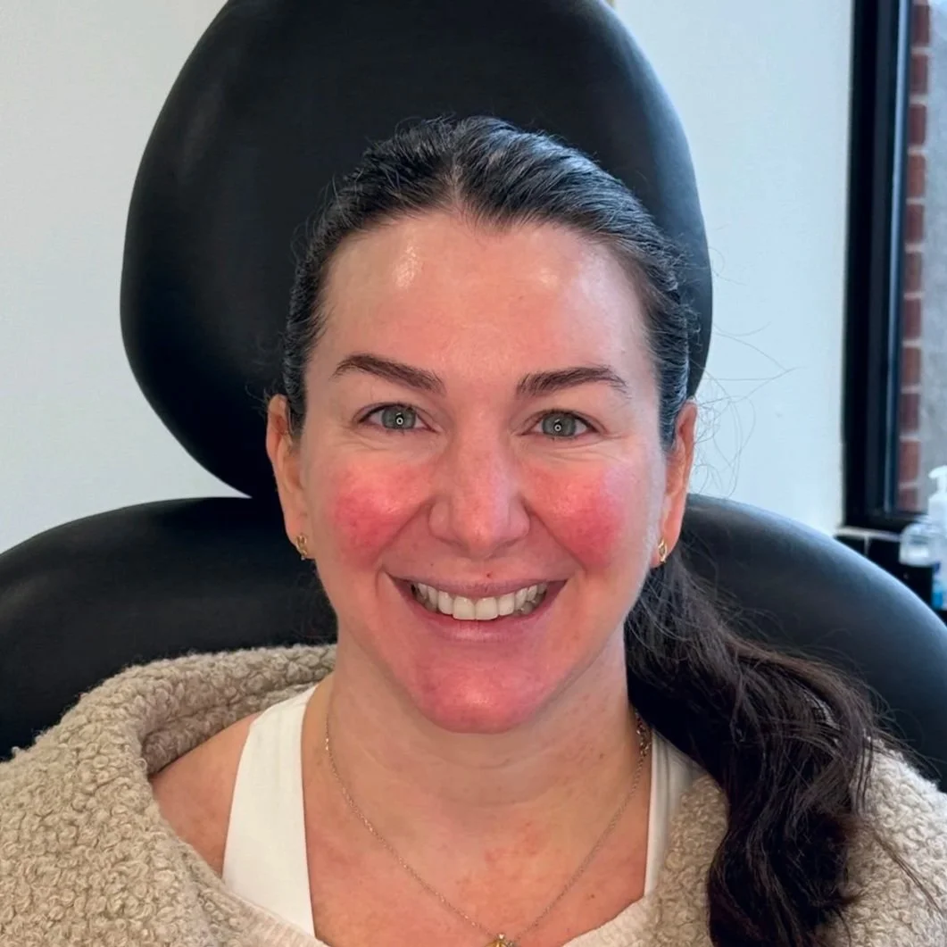 Female client after Neurotoxin treatment at Morph Med Spa in Ridgefield, CT – smoother forehead, brow, and eye-area appearance